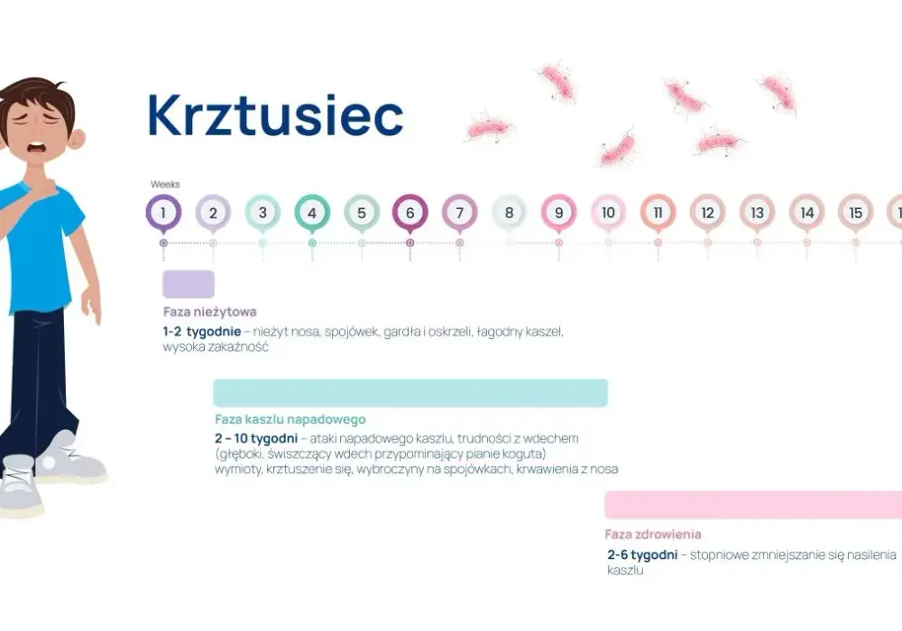 Jakie badanie na krztusiec? Poznaj kluczowe testy diagnostyczne