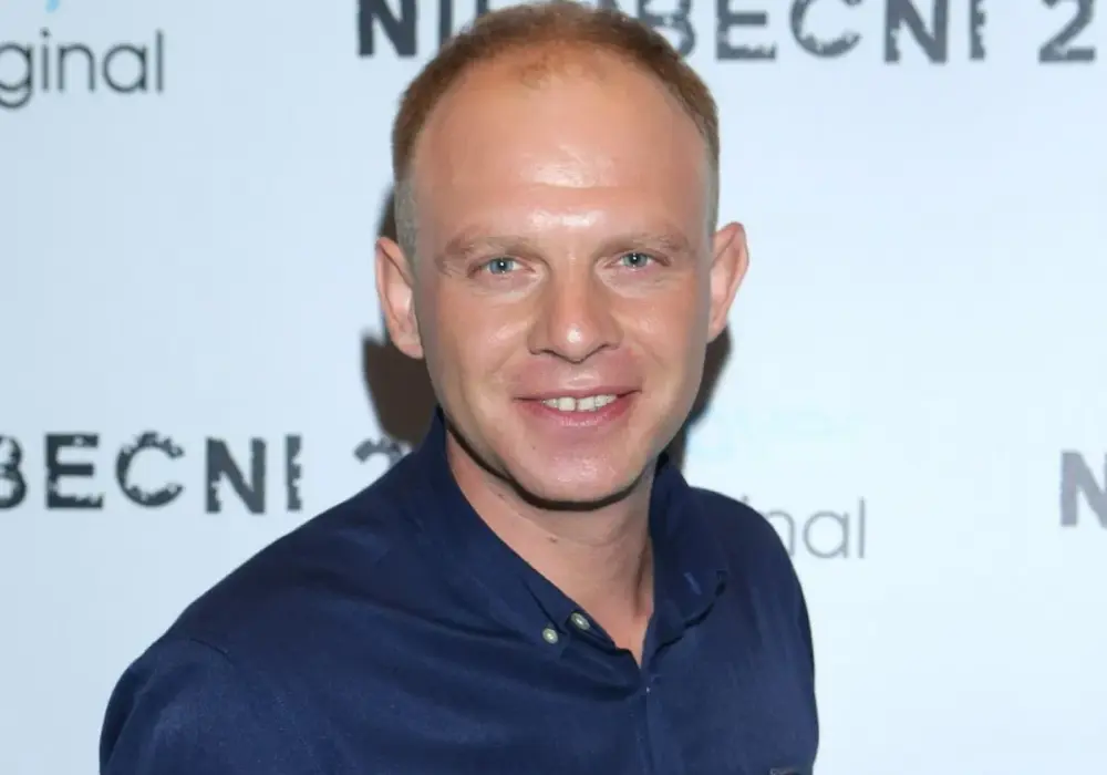 Kazimierz Mazur: Przeszczep włosów i metamorfoza co musisz wiedzieć?