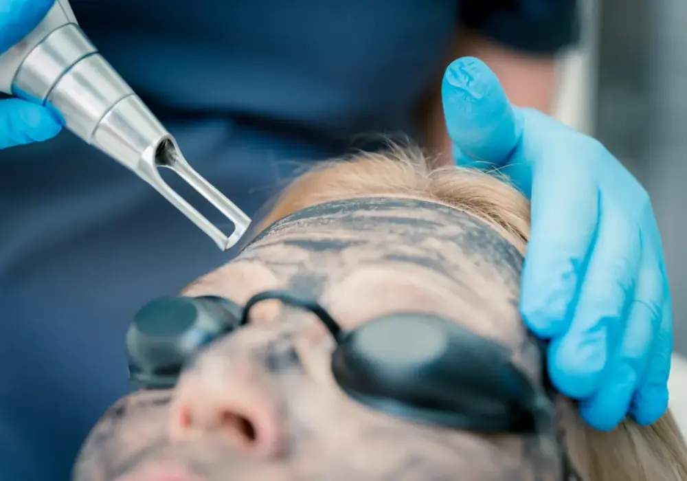 Peeling węglowy co daje: zaskakujące efekty dla Twojej skóry