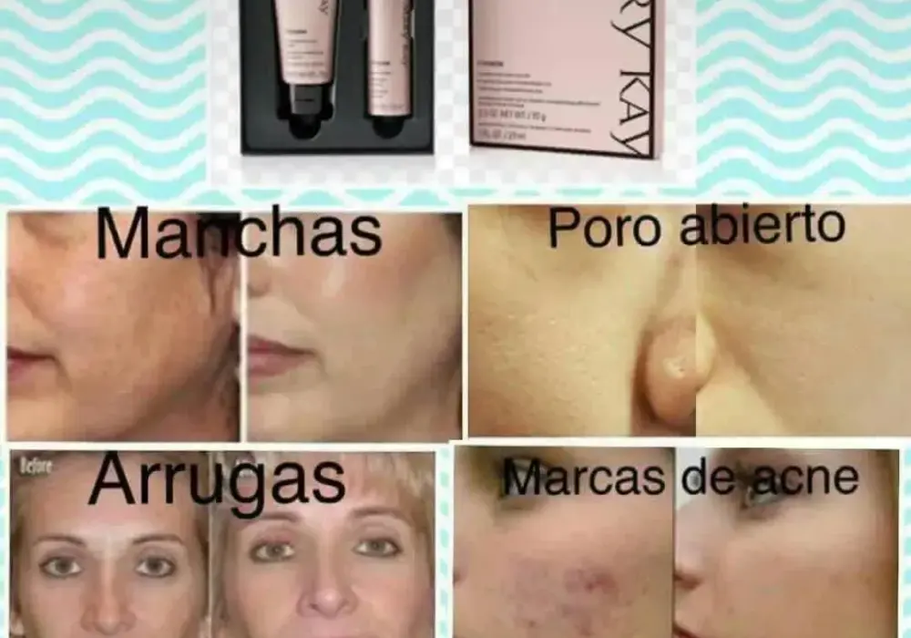 Mikrodermabrazja Mary Kay jak stosować, aby uniknąć podrażnień skóry