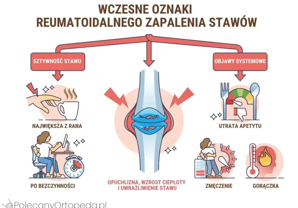 Guzki reumatoidalne - Czy to RZS? Rozpoznaj i działaj!