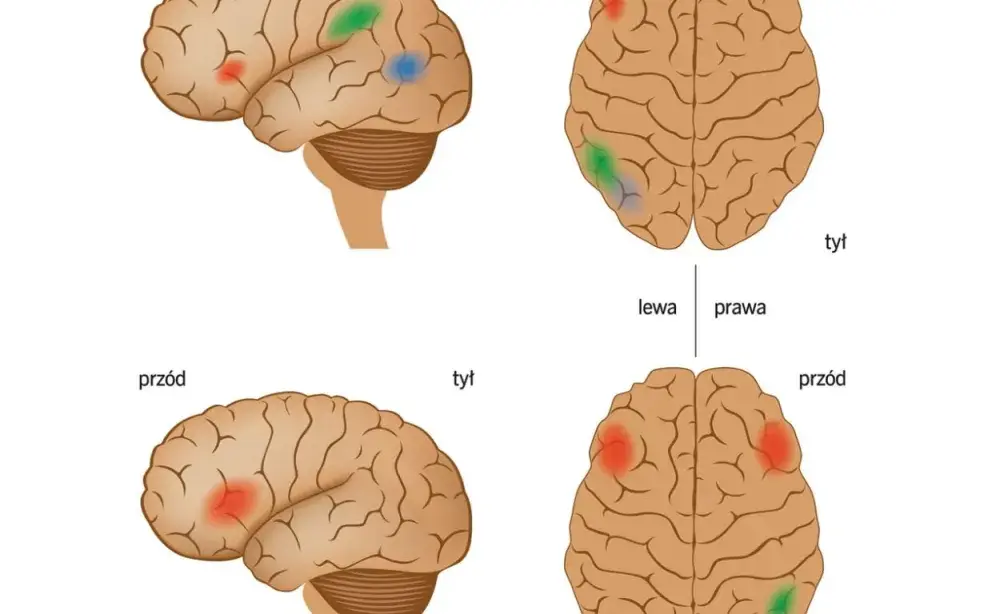 Zespół Aspergera a dysleksja: Czy mogą występować razem?