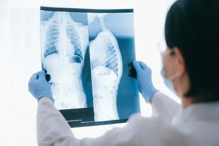 Jaki lekarz leczy osteoporozę: 5 najważniejszych specjalistów w terapii