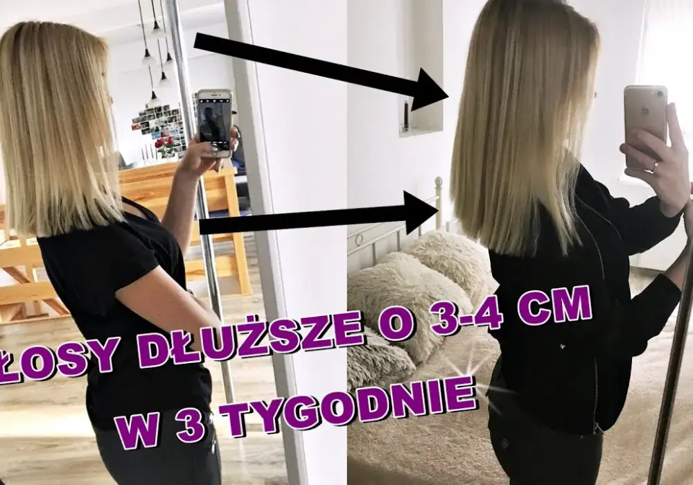 Jak przyspieszyć wzrost grzywki? Skuteczne metody na szybkie odrastanie