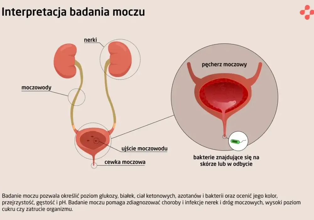 Leukocyty w moczu - interpretacja wyników. Kiedy martwić się?