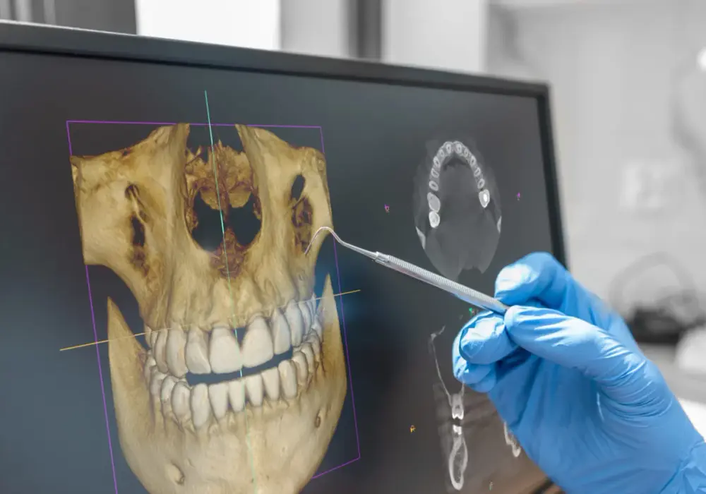 CBCT zębów - kiedy tomografia 3D ma sens?