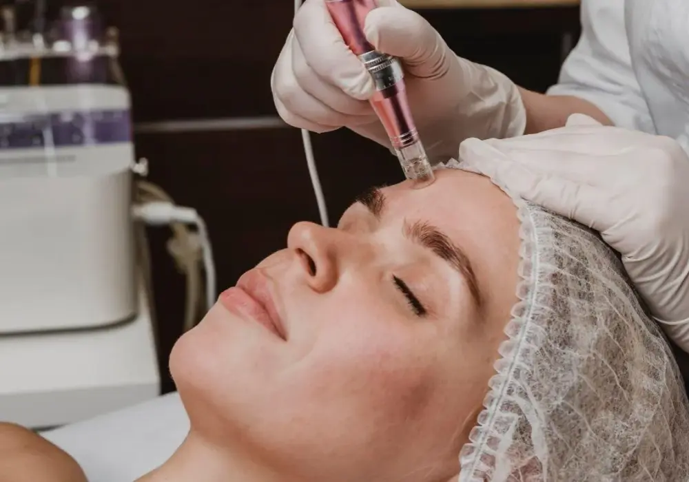 Co lepsze: dermapen czy laser frakcyjny - porównanie efektów i korzyści