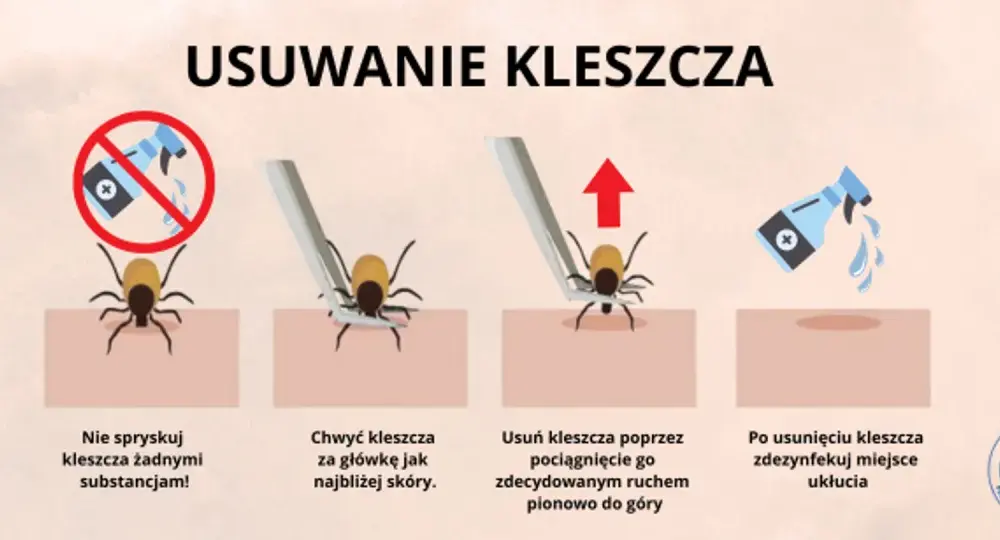 Smarowanie kleszcza tłuszczem? To błąd! Jak usunąć go bezpiecznie?