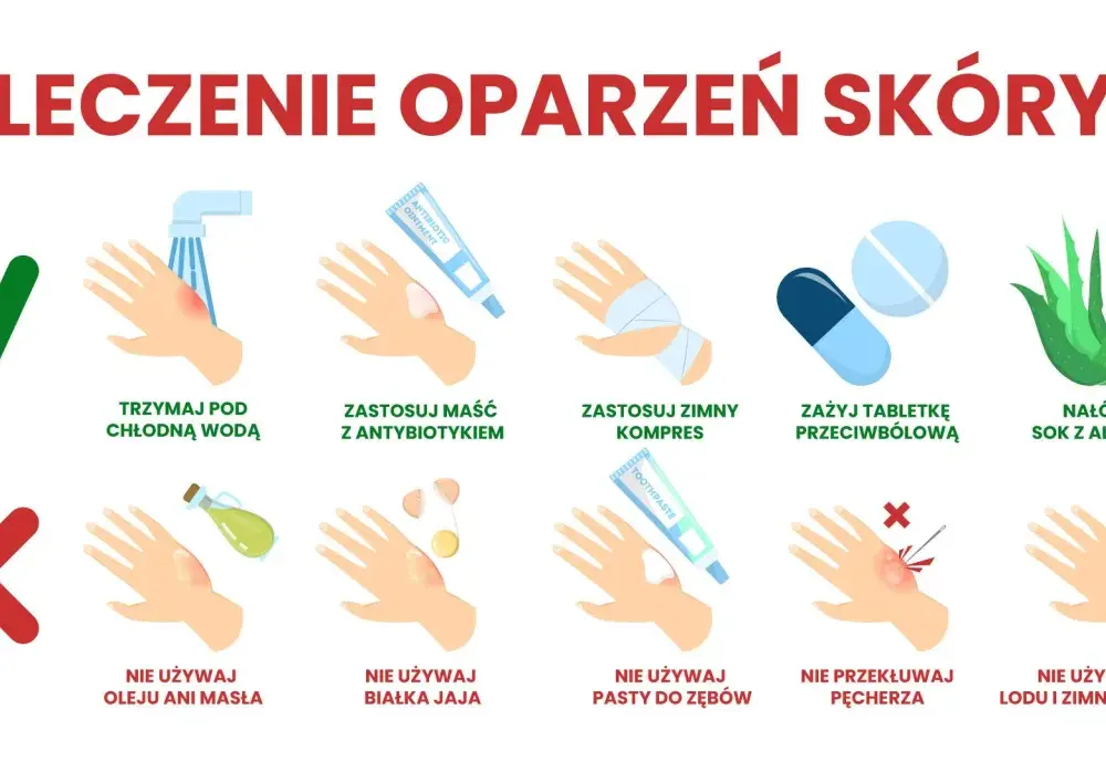 Oparzenia skóry - pierwsza pomoc, leczenie i pielęgnacja bez śladów