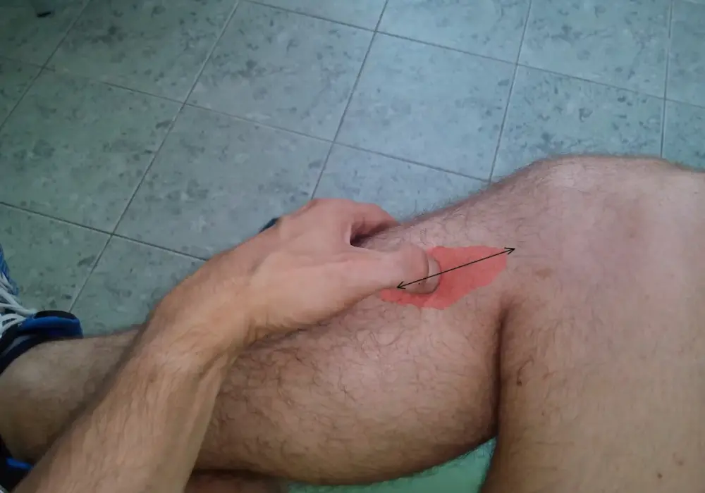 Mięsień podkolanowy - Klucz do stabilności kolana?