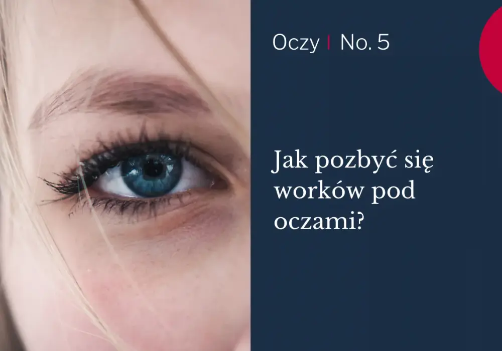 Worki pod oczami - Jak wybrać skuteczny zabieg? Poradnik