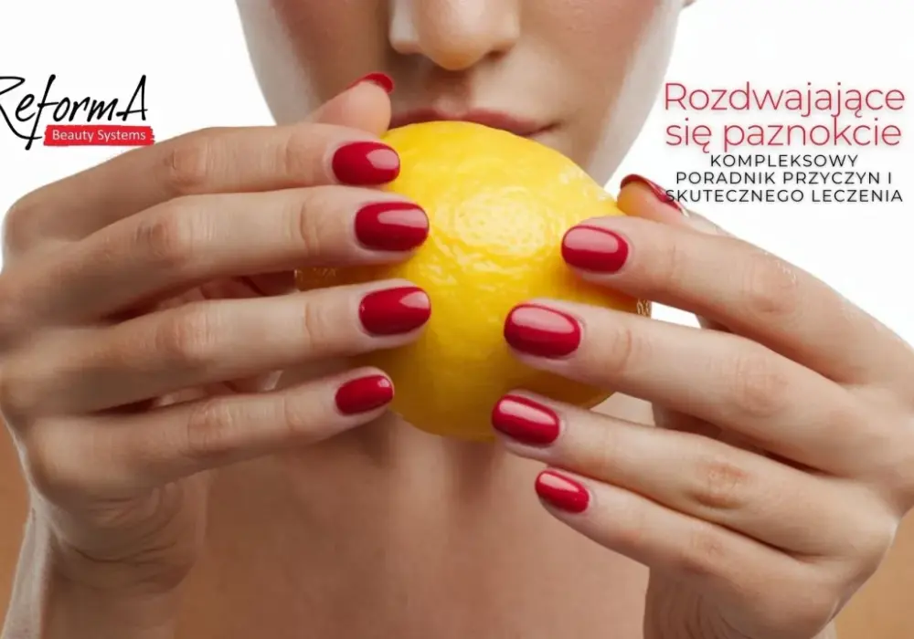 Pękające paznokcie - Przyczyny i skuteczne rozwiązania