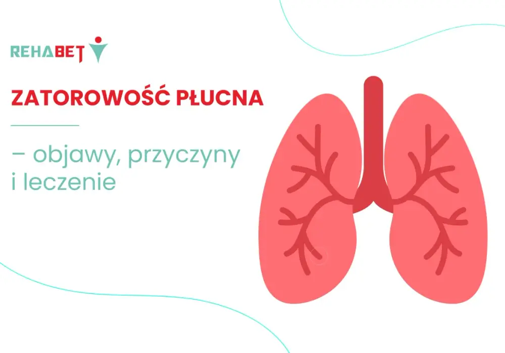 Zatorowość płucna - objawy, diagnostyka i leczenie