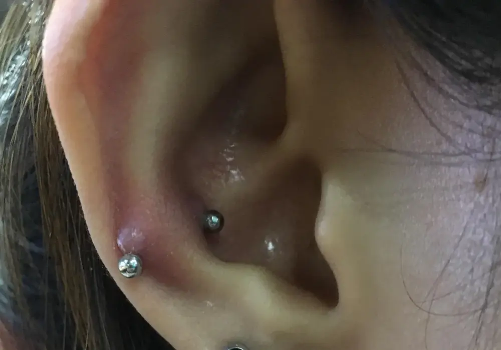 Snug piercing - czy Twoje ucho się nadaje? Ból i gojenie