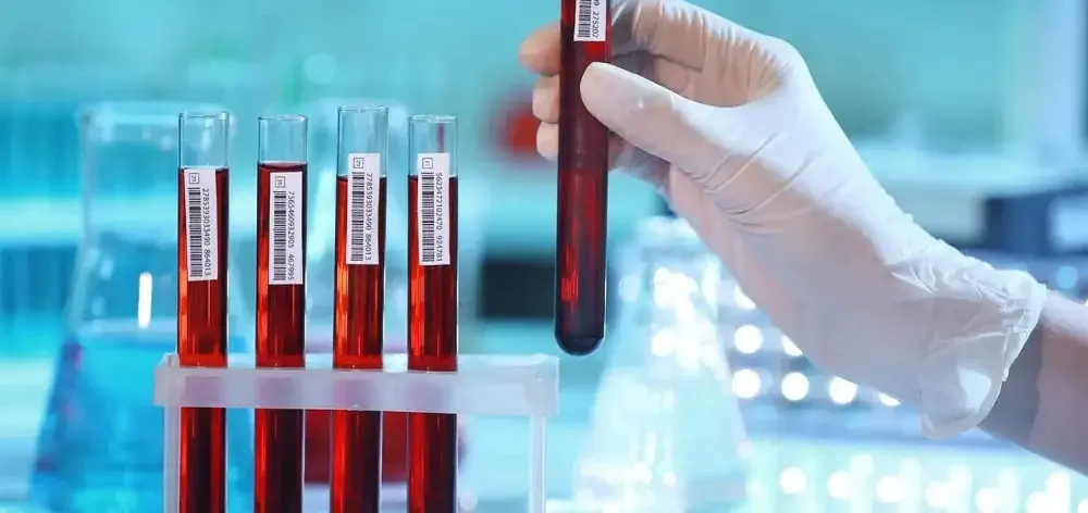 Jakie badanie krwi w kierunku Hashimoto pomoże w diagnozie?