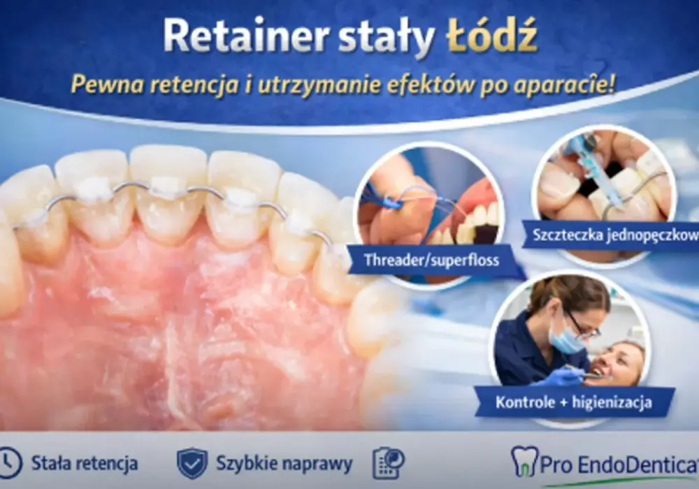 Retainer po polsku - co to jest i jak utrzymać efekt leczenia?