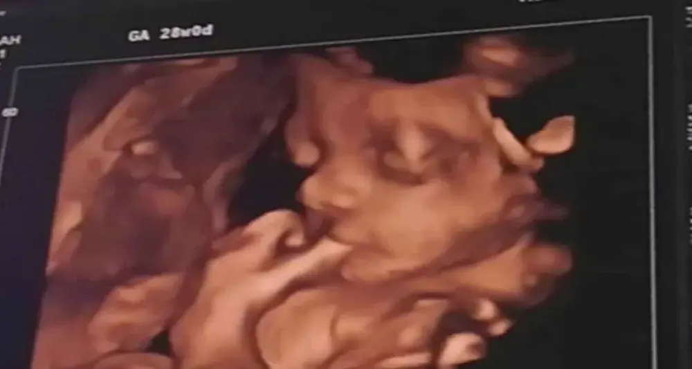 Agatowa echo serca - Kiedy warto je wykonać i jak czytać wyniki?