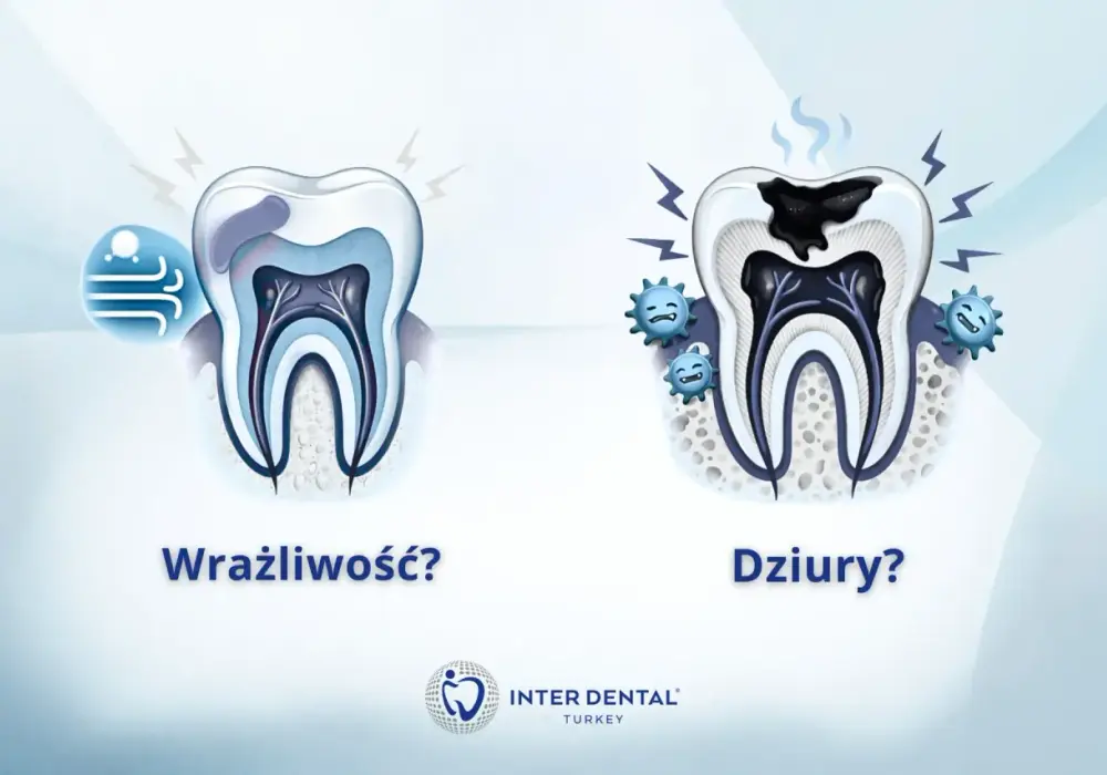 Ból zęba przy gryzieniu? To nie nadwrażliwość! Sprawdź, co oznacza