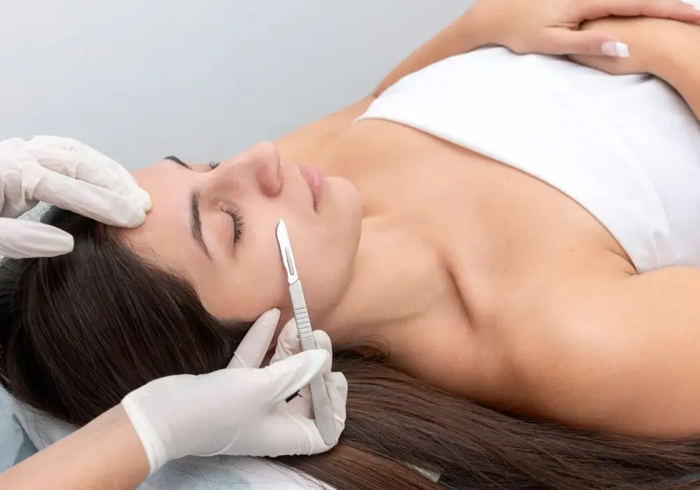 Dermaplaning - czy warto? Efekty, cena, przeciwwskazania