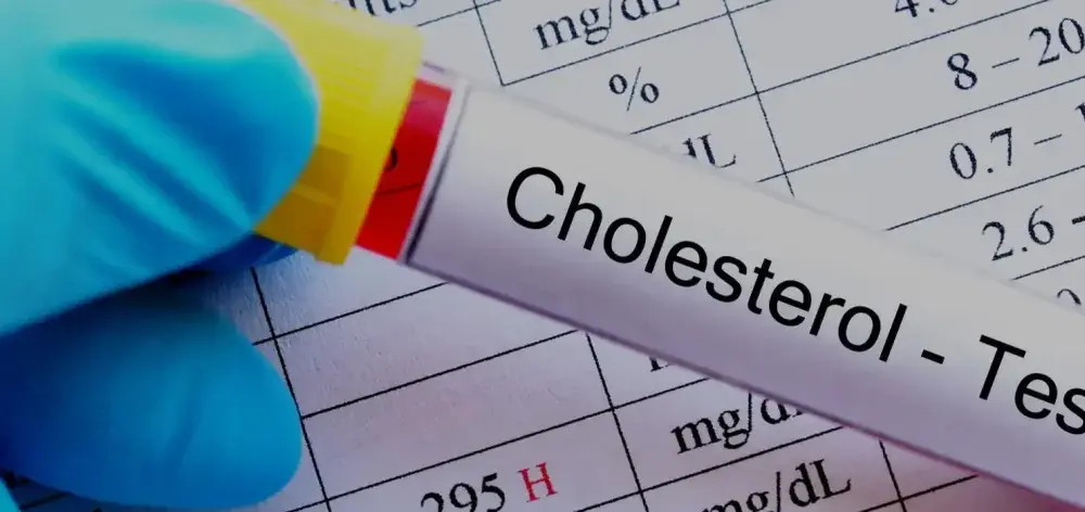 Czy cholesterol jest dziedziczny? Poznaj ryzyko i skutki zdrowotne