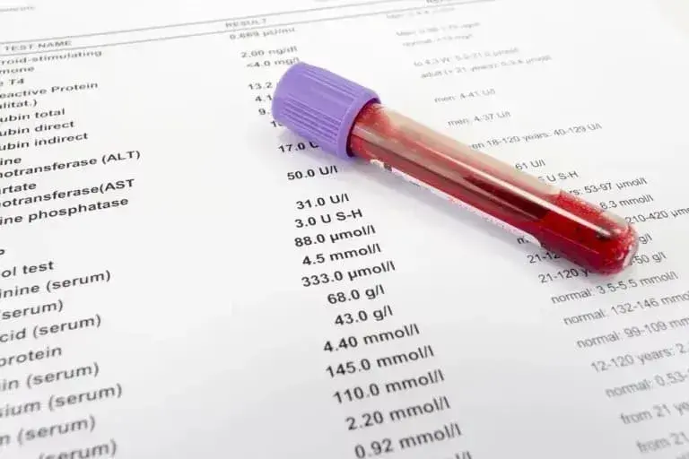 Jak sprawdzić cholesterol? Kluczowe informacje o badaniach i wynikach