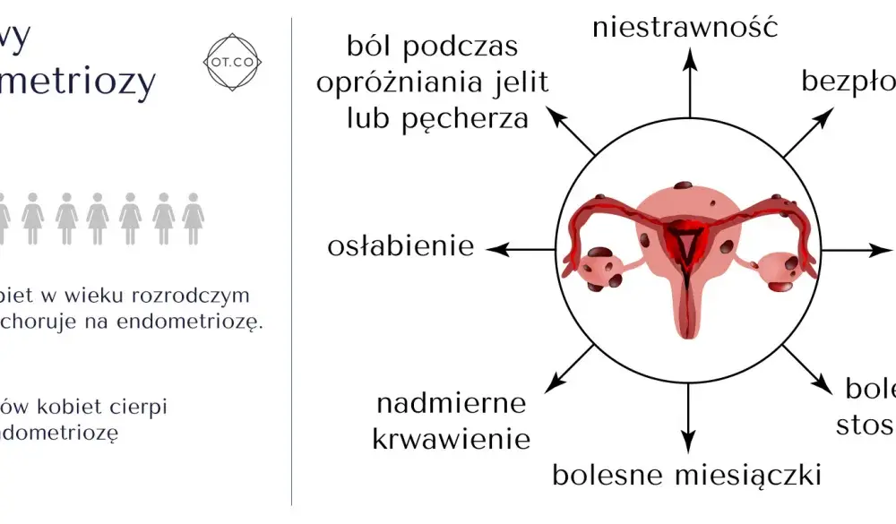 Endovelle - na endometriozę, nie antykoncepcję? Poznaj fakty!