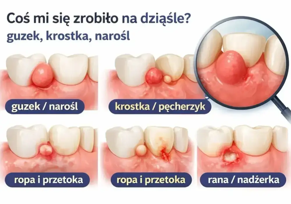 Ból zęba - Jaki lek wybrać i kiedy do dentysty?