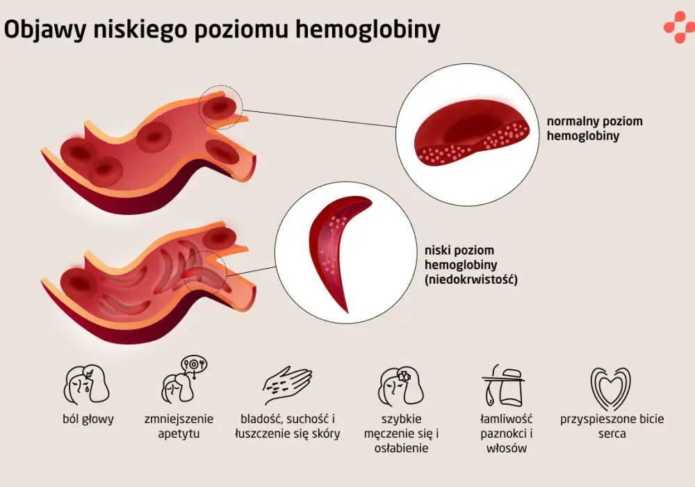 Niskie erytrocyty - Co oznaczają i kiedy reagować?