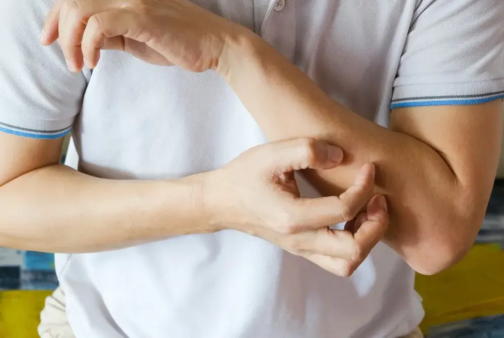HIV objawy skórne - Jak je rozpoznać i kiedy zrobić test?