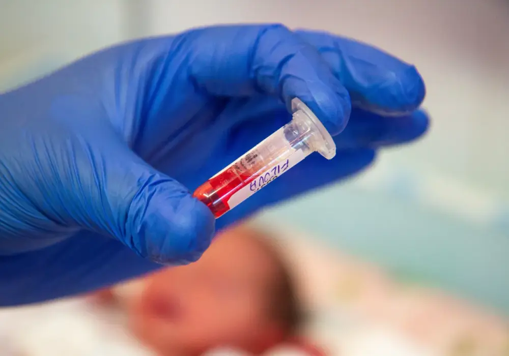 Co to jest PKU i jak diagnozuje się tę chorobę?