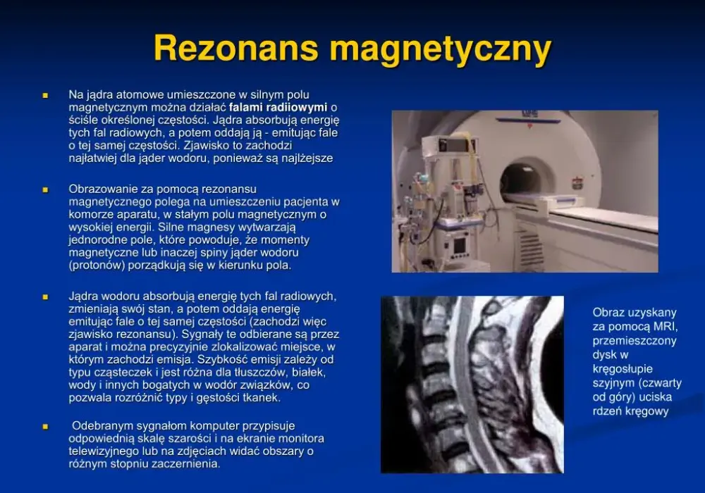 Co to jest rezonans magnetyczny? Fizyczne podstawy zjawiska prosto wyjaśnione