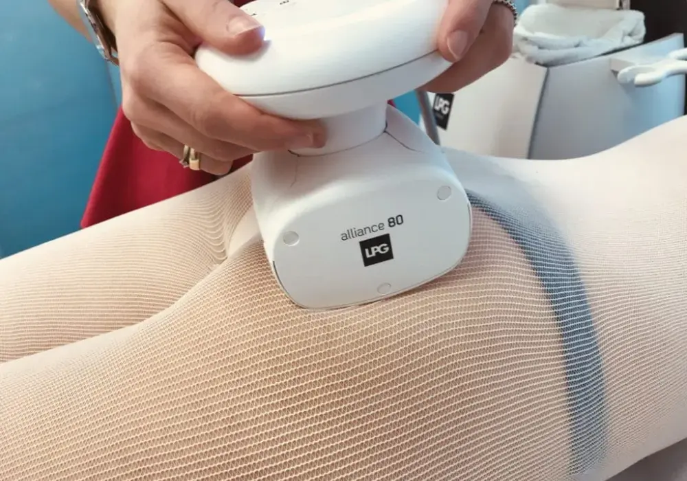 Endermologia integral czy alliance – która metoda jest skuteczniejsza?