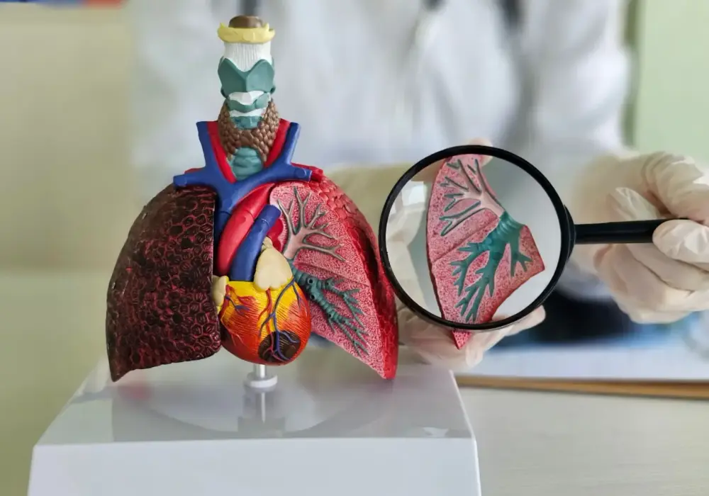 Włóknienie płuc - objawy, badania i leczenie, które spowalnia chorobę