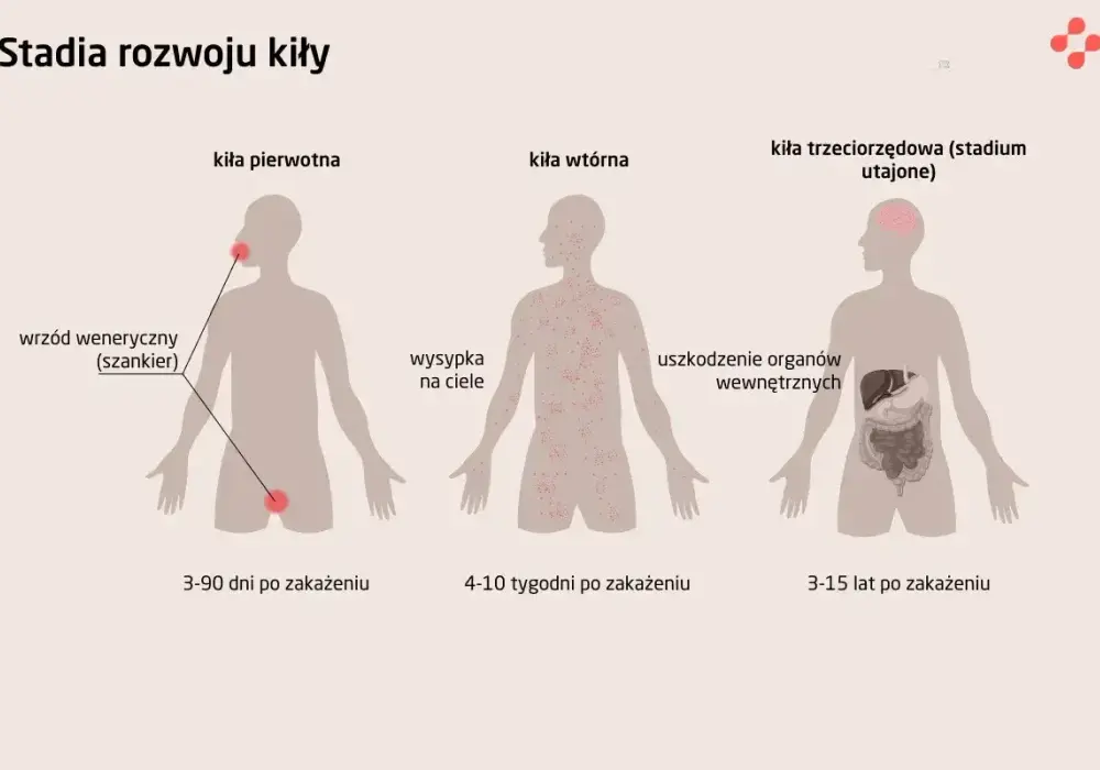 Kiła - jak ją rozpoznać, zbadać i skutecznie leczyć