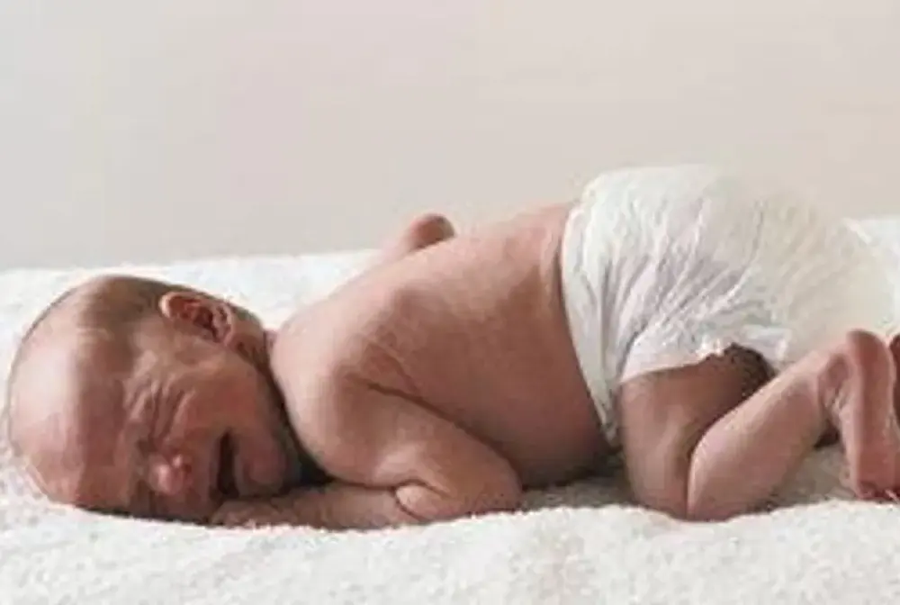 Neuroblastoma u dziecka - objawy, diagnostyka i leczenie