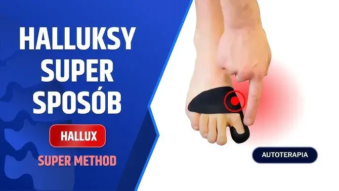 Jak tejpować haluksa, aby złagodzić ból i poprawić komfort stóp
