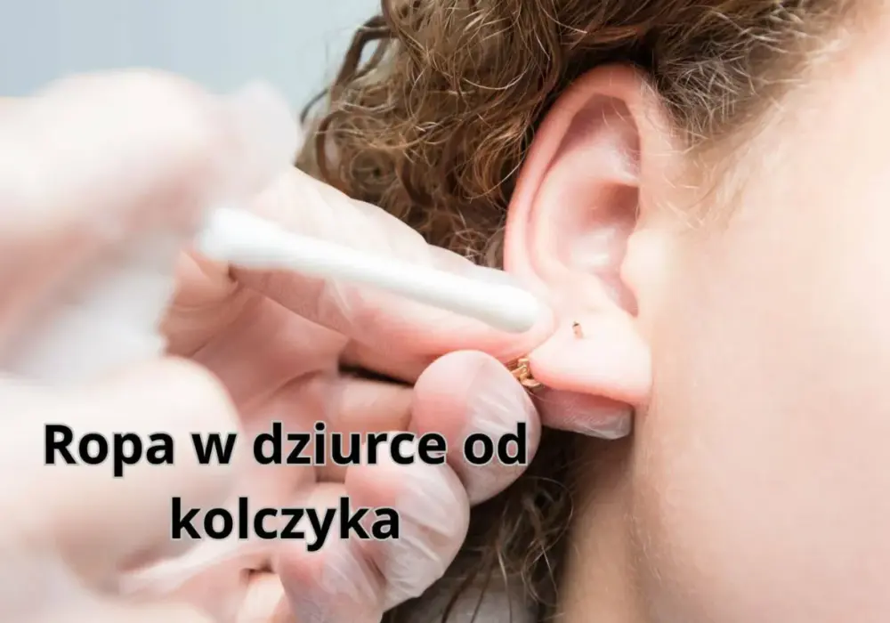 Limfa z kolczyka czy ropa? Rozpoznaj i pielęgnuj!