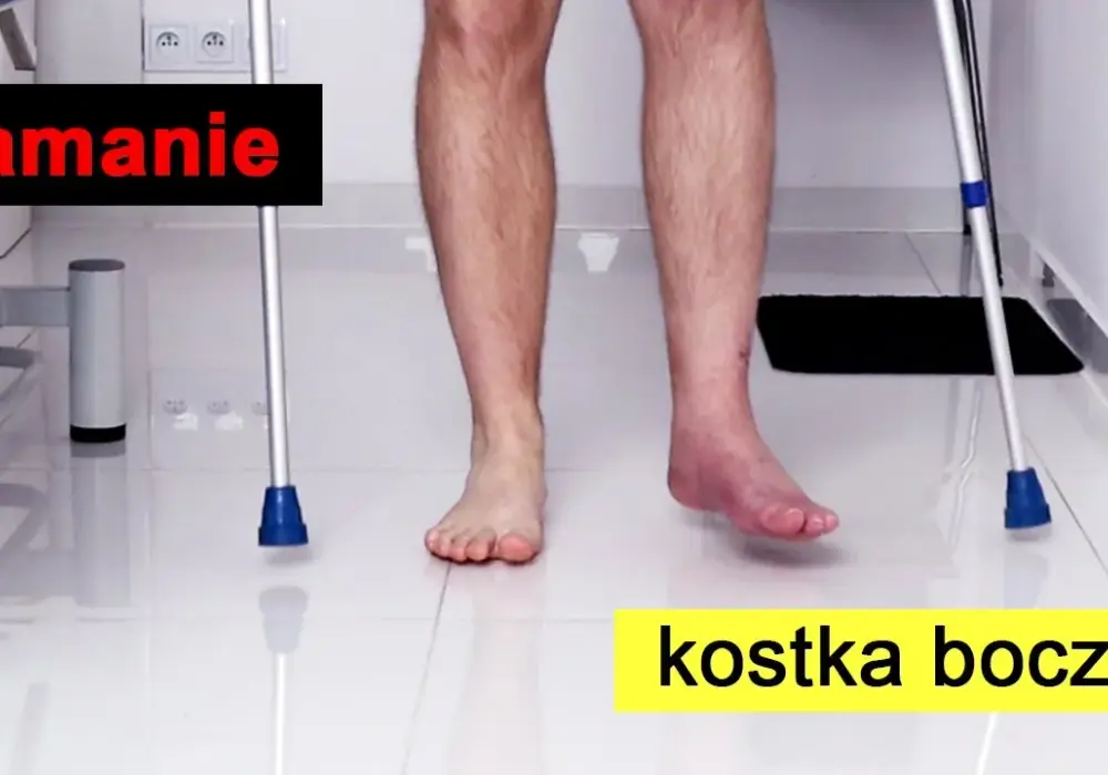 Jak ćwiczyć nogę po zdjęciu gipsu, aby uniknąć bólu i szybkiej rehabilitacji