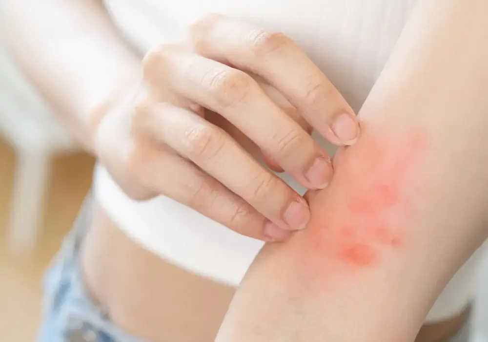 Autoimmunologiczne choroby skóry - Kiedy zmiany to coś więcej?