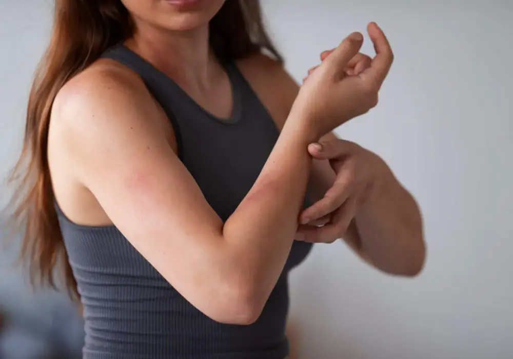 Alergia na kurz i roztocza objawy - jak je rozpoznać i leczyć