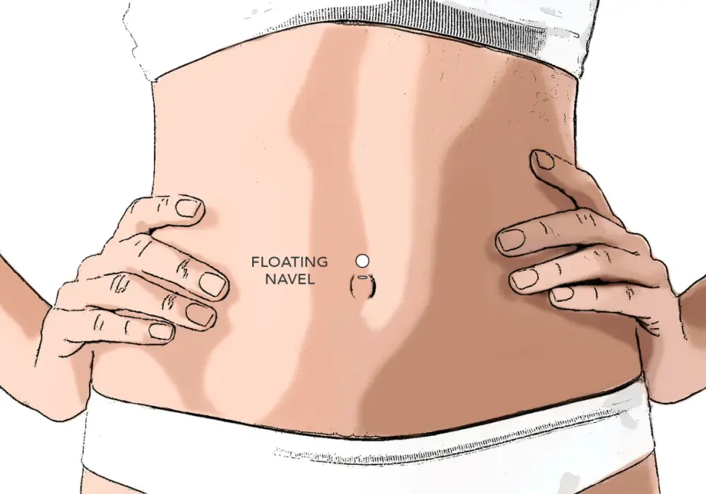 Floating navel - Przekłucie pępka dopasowane do anatomii