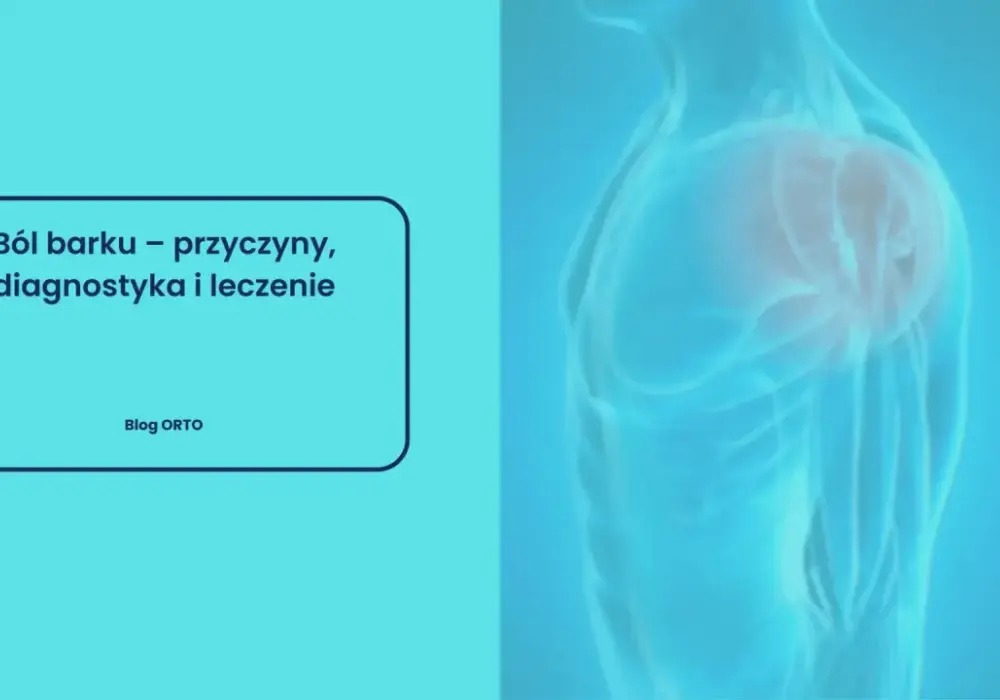 Ból barku - 5 przyczyn, diagnostyka i sygnały alarmowe
