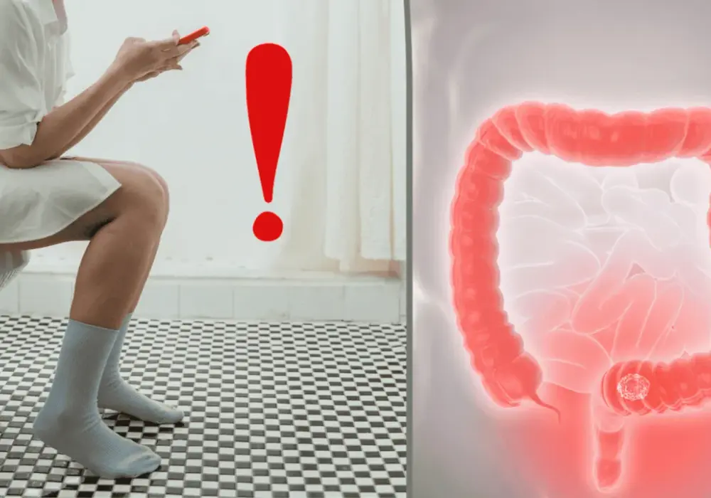 Wygląd stolca przy raku jelita - Jakie objawy są alarmujące?
