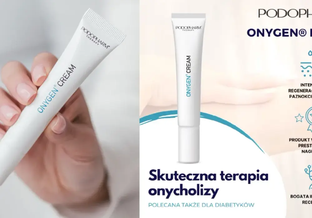 Onygen na onycholizę - kiedy warto go stosować?