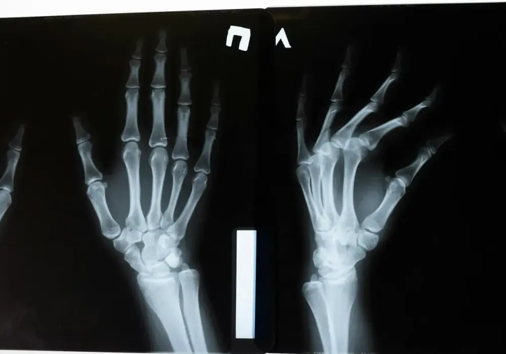 Rentgen - Od odkrycia do diagnostyki. Jak działa RTG?
