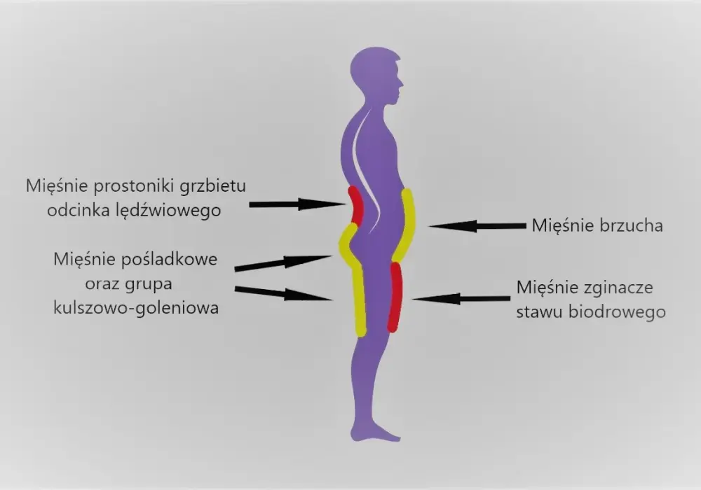 Lordoza lędźwiowa - kiedy jest problemem? Objawy i ćwiczenia