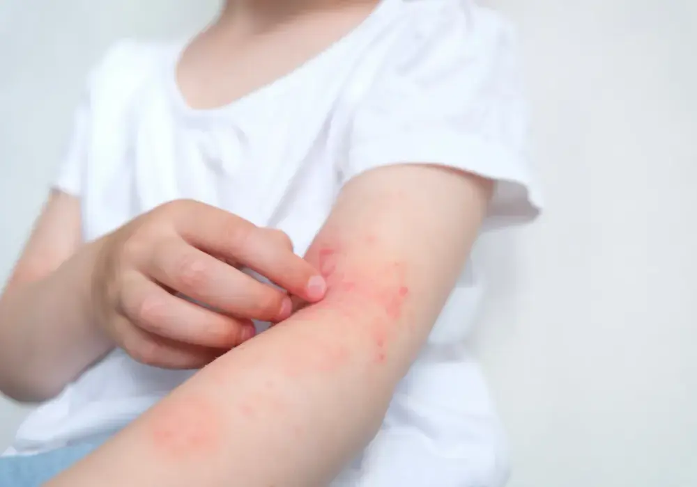 Nutramil - Kiedy ma sens? Różnice, alergia, błędy.