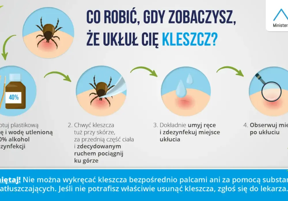 Kleszcz co robić: Jak bezpiecznie usunąć kleszcza i uniknąć chorób