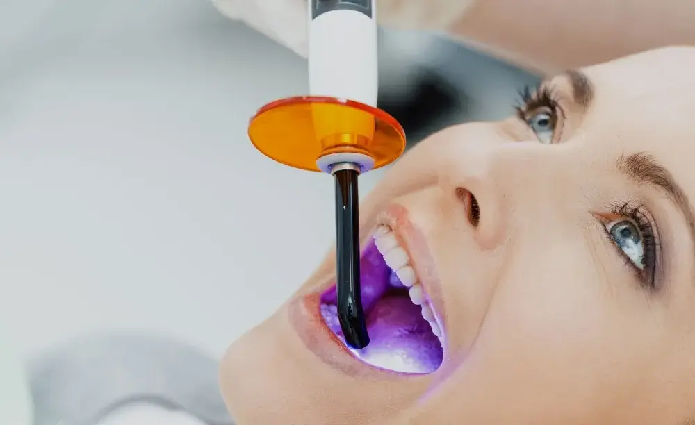 Jak wygląda wybielanie zębów u dentysty? Odkryj skuteczne metody i efekty