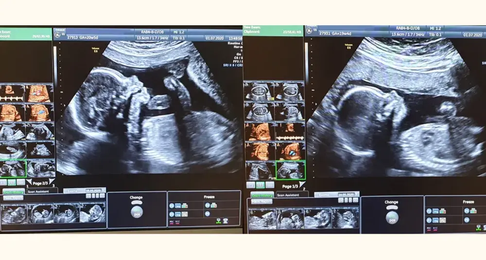 Jak wyglądają badania prenatalne i co warto o nich wiedzieć?